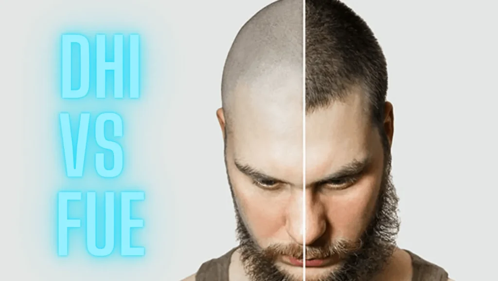 FUE and DHI Hair Transplant